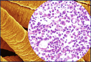 CNTs mimic asbestos fibers 